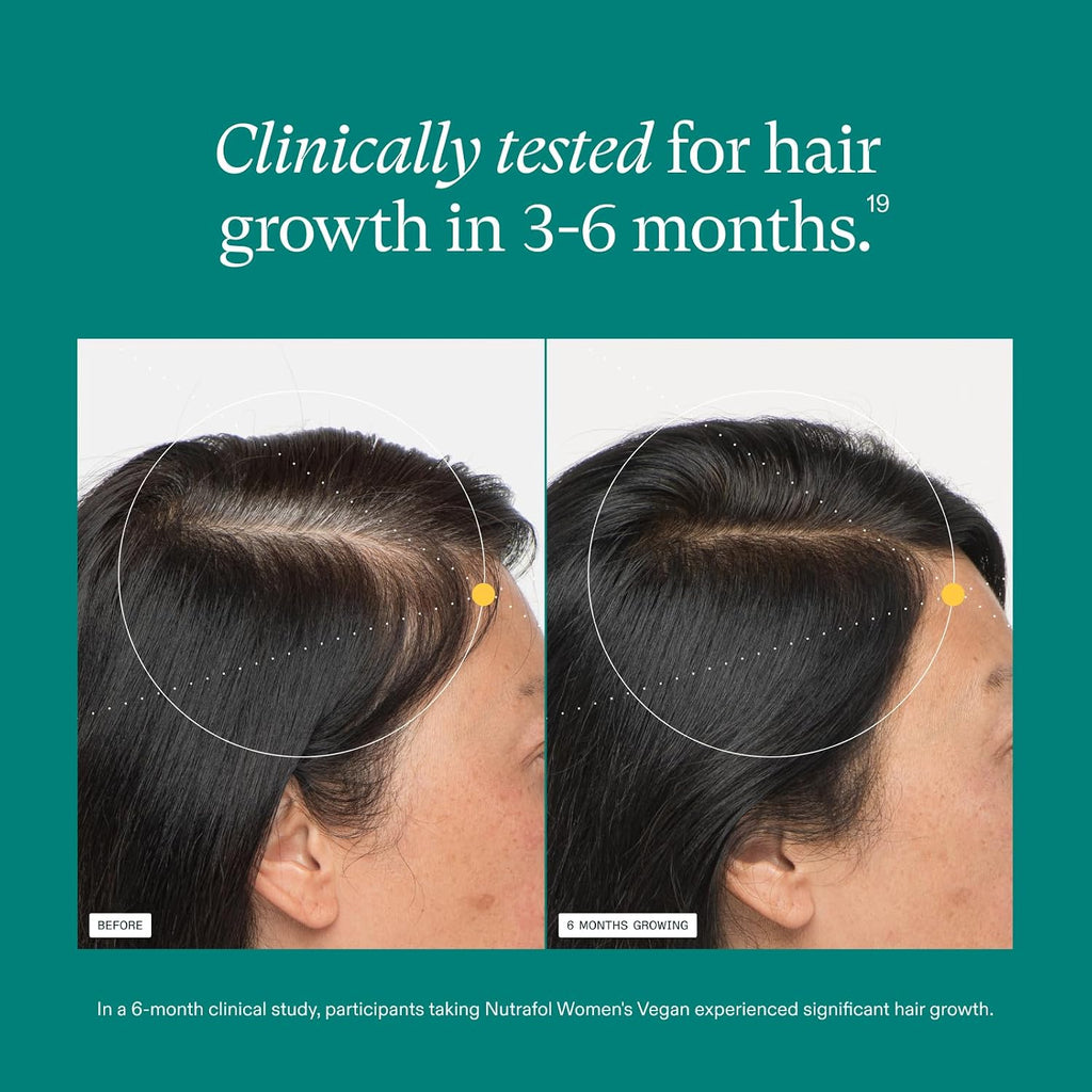 Nutrafol Women's Hair Growth Supplements, for Women 18-44 Years Old, Clinically Tested for Visibly Thicker, Stronger Hair, 100% Vegan Ingredients, Dermatologist Recommended - 2 Month Supply