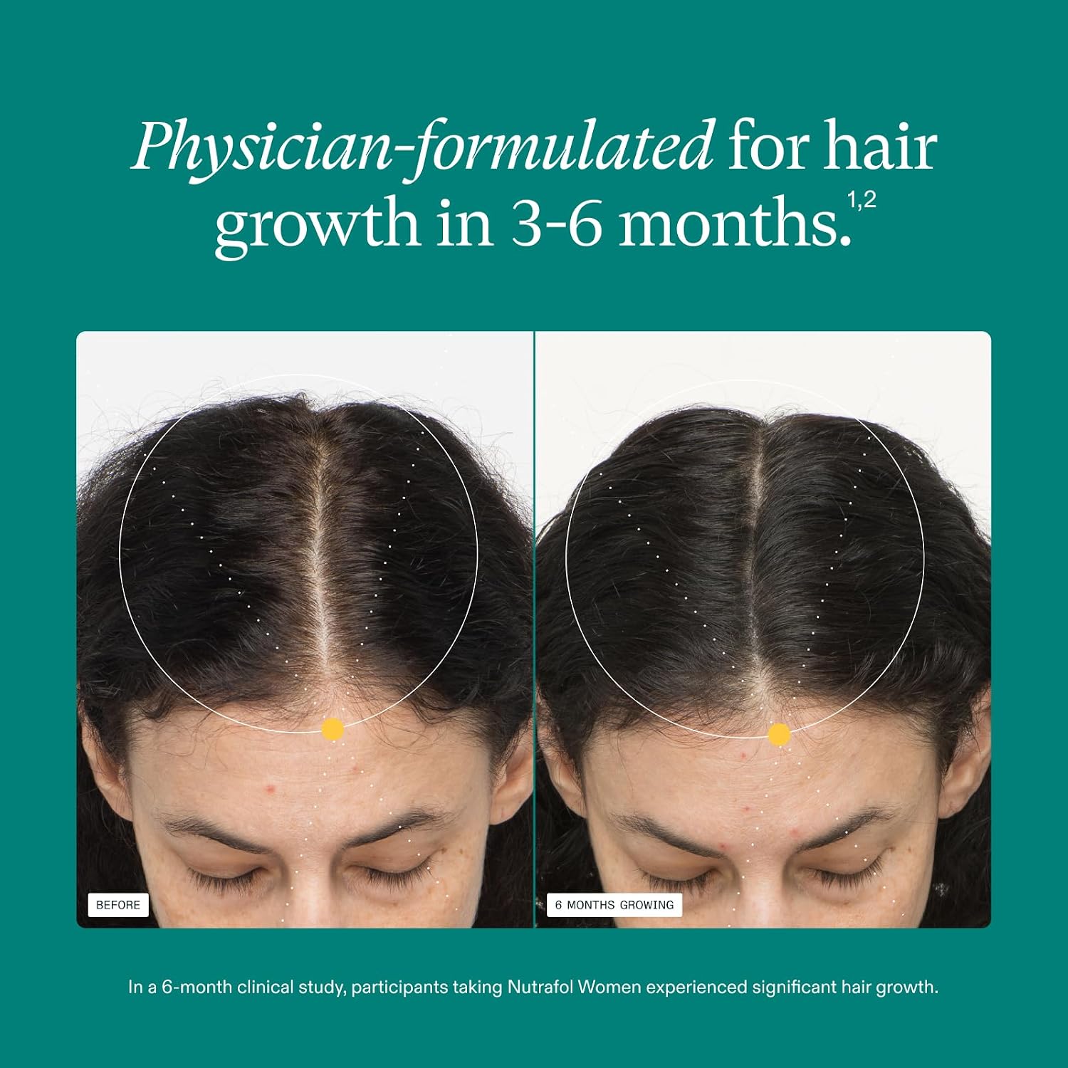 Nutrafol Women's Hair Growth Supplements, Dermatologist Recommended, Ages 18-44, Clinically Proven for Visibly Thicker and Stronger Hair - 2 Month Supply, Pack of 2