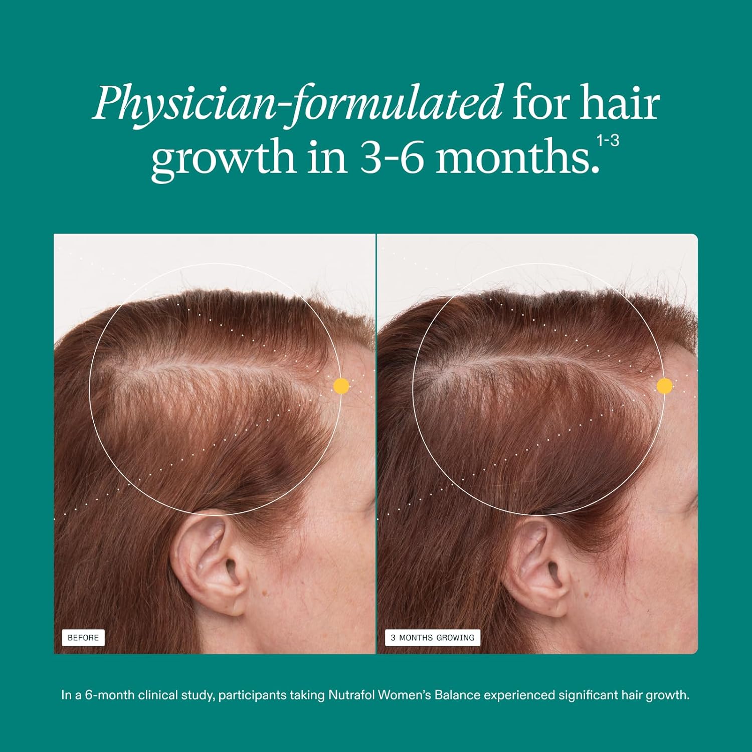 Nutrafol Women's Balance Hair Growth Supplements, for Ages 45+, Clinically Proven for Visibly Thicker Hair and Scalp Coverage, Dermatologist Recommended - 2 Month Supply, 2 Refill Pouches